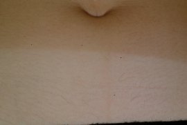 Abdomen of female - After