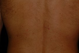 male lowerback - After