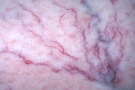 Close up of patient - Before