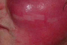 4 small test rectangular spots - After