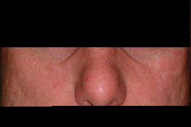 NO MORE FLUSHING - Before