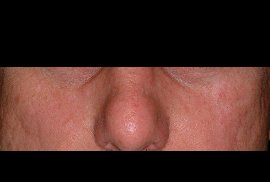 NO MORE FLUSHING -After