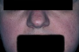 FLUSHING CLEARED - After