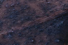 elevated scar - Before