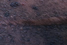 elevated scar - After