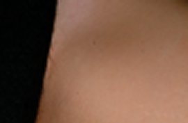 Bikini of 30 yr old female - After